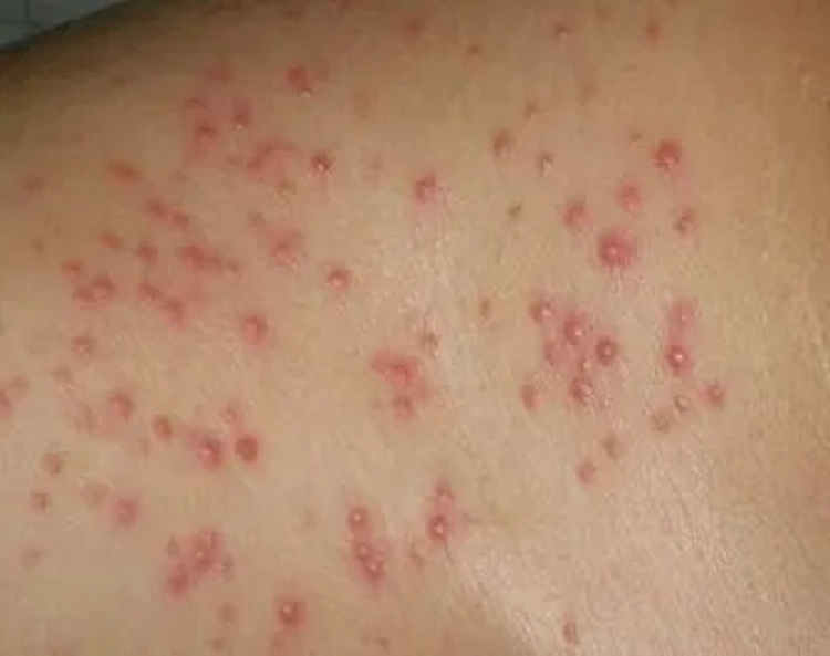珠海香洲皮肤医院在哪里